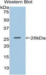 Western blot of recombinant F8A1 / HAP40.