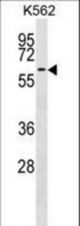 F9 Antibody western blot of K562 cell line lysates (35 ug/lane). The F9 antibody detected the F9 protein (arrow).