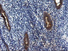 IHC of paraffin-embedded Human endometrium tissue using anti-CNOT4 mouse monoclonal antibody.