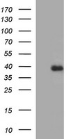 HEK293T cells were transfected with the pCMV6-ENTRY control (Left lane) or pCMV6-ENTRY FA2H (Right lane) cDNA for 48 hrs and lysed. Equivalent amounts of cell lysates (5 ug per lane) were separated by SDS-PAGE and immunoblotted with anti-FA2H.