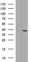 HEK293T cells were transfected with the pCMV6-ENTRY control (Left lane) or pCMV6-ENTRY FA2H (Right lane) cDNA for 48 hrs and lysed. Equivalent amounts of cell lysates (5 ug per lane) were separated by SDS-PAGE and immunoblotted with anti-FA2H.