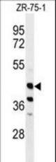 Western blot of FA2H Antibody in ZR-75-1 cell line lysates (35 ug/lane). FA2H (arrow) was detected using the purified antibody.