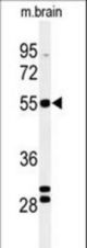 Western blot of FA2H Antibody in mouse brain tissue lysates (35 ug/lane). FA2H (arrow) was detected using the purified antibody.
