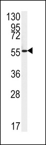 Western blot of FAAH2 Antibody in HepG2 cell line lysates (35 ug/lane). FAAH2 (arrow) was detected using the purified antibody.