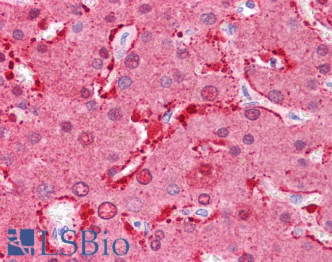 Anti-FABP1 antibody IHC of human liver. Immunohistochemistry of formalin-fixed, paraffin-embedded tissue after heat-induced antigen retrieval. Antibody LS-B4666 concentration 5 ug/ml.