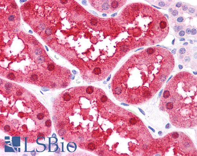 Anti-FABP1 antibody IHC of human kidney. Immunohistochemistry of formalin-fixed, paraffin-embedded tissue after heat-induced antigen retrieval. Antibody LS-B4666 concentration 5 ug/ml.