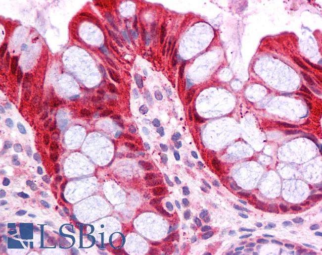 Anti-FABP1 antibody IHC of human colon. Immunohistochemistry of formalin-fixed, paraffin-embedded tissue after heat-induced antigen retrieval. Antibody LS-B4666 concentration 5 ug/ml.