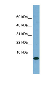 FABP1 antibody LS-B4666 Western blot of Fetal Small Intestine lysate.