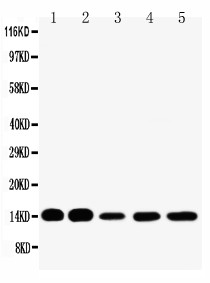 WB of FABP1 / L-FABP antibody. All lanes: Anti-FABP1 at 0.5ug/ml. Lane 1: Rat Liver Tissue Lysate at 40ug. Lane 2: Rat Kidney Tissue Lysate at 40ug. Lane 3: HELA Whole Cell Lysate at 40ug. Lane 4: NEURO Whole Cell Lysate at 40ug. Lane 5: SMMC Whole Cell Lysate at 40ug. Predicted bind size: 14KD. Observed bind size: 14KD.