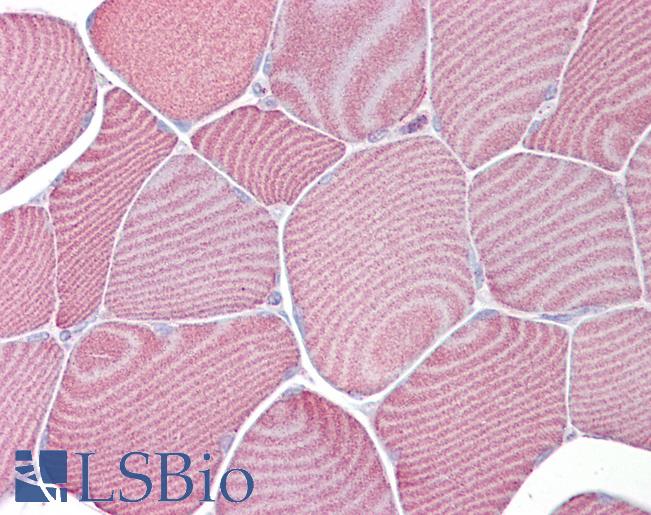 Anti-FABP3 antibody IHC of human skeletal muscle. Immunohistochemistry of formalin-fixed, paraffin-embedded tissue after heat-induced antigen retrieval. Antibody LS-B6876 concentration 5 ug/ml.
