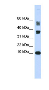 FABP3 antibody LS-B6876 Western blot of Fetal Heart lysate.