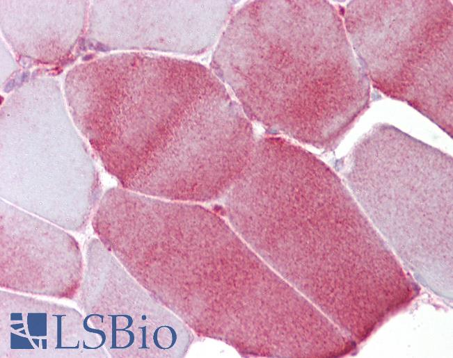 Anti-FABP3 antibody IHC of human skeletal muscle. Immunohistochemistry of formalin-fixed, paraffin-embedded tissue after heat-induced antigen retrieval. Antibody LS-B6877 concentration 5 ug/ml.