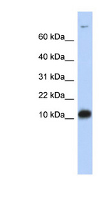 FABP3 antibody LS-B6877 Western blot of Fetal Brain lysate.