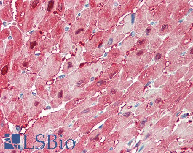 Anti-FABP3 / H-FABP antibody IHC staining of human heart. Immunohistochemistry of formalin-fixed, paraffin-embedded tissue after heat-induced antigen retrieval. Antibody LS-B11195 concentration 5 ug/ml.