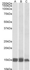 FABP3 antibody (0.01 ug/ml) staining of Human (A), Mouse (B) and Rat(C) Heart lysates (35 ug protein in RIPA buffer). Primary incubation was 1 hour. Detected by chemiluminescence.