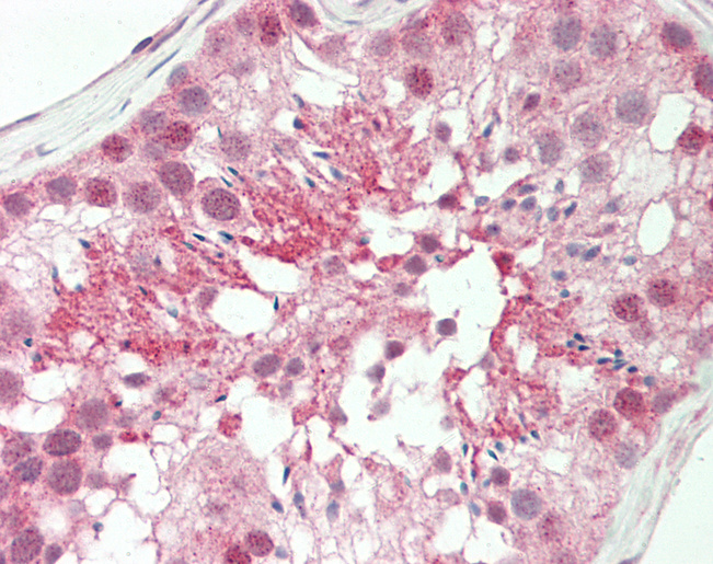 Human Testis: Formalin-Fixed, Paraffin-Embedded (FFPE)
