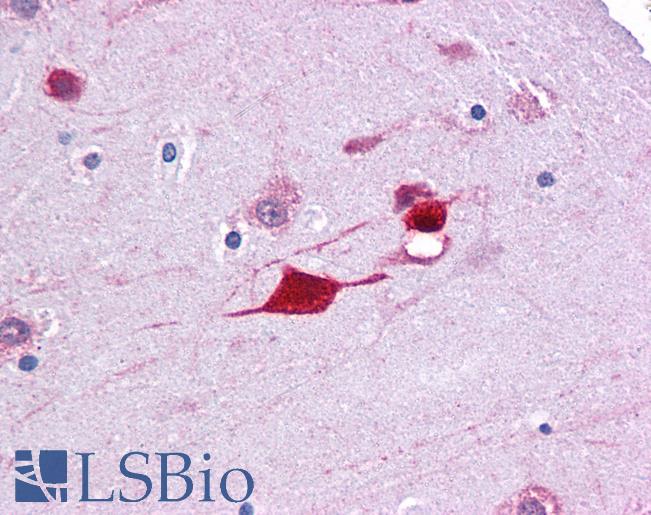Anti-FABP4 antibody IHC of human brain, cortex. Immunohistochemistry of formalin-fixed, paraffin-embedded tissue after heat-induced antigen retrieval. Antibody LS-B4574 concentration 5 ug/ml.