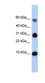 FABP4 antibody LS-B4574 Western blot of Fetal Muscle lysate.