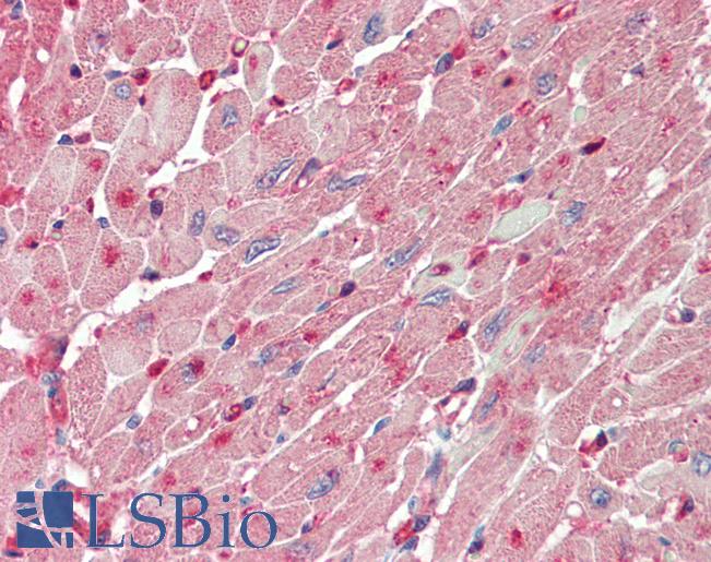 Anti-FABP4 / AP2 antibody IHC staining of human heart. Immunohistochemistry of formalin-fixed, paraffin-embedded tissue after heat-induced antigen retrieval. Antibody LS-B11196 concentration 5 ug/ml.