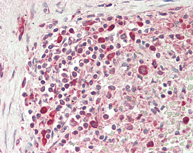 Human Spleen: Formalin-Fixed, Paraffin-Embedded (FFPE)