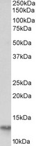 FABP4 antibody (0.03 ug/ml) staining of Human Adipose lysate (35 ug protein in RIPA buffer). Primary incubation was 1 hour. Detected by chemiluminescence.