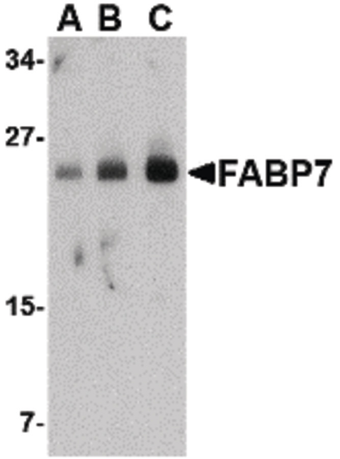 Western blot of FABP7 in human breast tissue lysate with FABP7 antibody at (A) 0.5, (B) 1 and (C) 2 ug/ml.