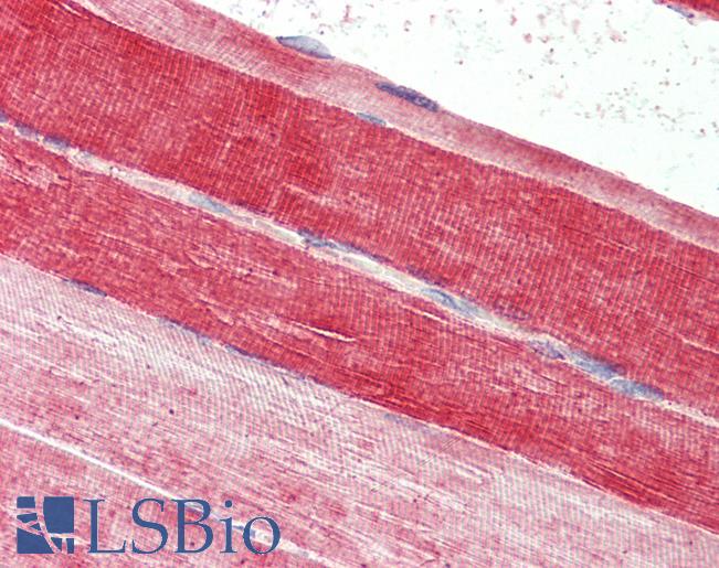 Anti-FABP7 / BLBP antibody IHC of human skeletal muscle. Immunohistochemistry of formalin-fixed, paraffin-embedded tissue after heat-induced antigen retrieval. Antibody LS-B4173 concentration 2.5 ug/ml.