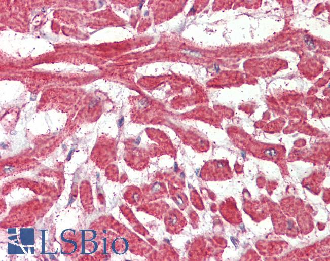 Anti-FABP7 / BLBP antibody IHC of human heart. Immunohistochemistry of formalin-fixed, paraffin-embedded tissue after heat-induced antigen retrieval. Antibody LS-B4173 concentration 2.5 ug/ml.