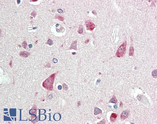 Anti-FAC1 / BPTF antibody IHC staining of human brain, cortex. Immunohistochemistry of formalin-fixed, paraffin-embedded tissue after heat-induced antigen retrieval. Antibody LS-B10731 dilution 1:50.