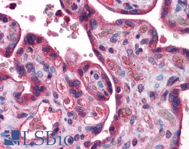 Anti-ACSL1 antibody IHC of human placenta. Immunohistochemistry of formalin-fixed, paraffin-embedded tissue after heat-induced antigen retrieval. Antibody LS-B5593 concentration 5 ug/ml.