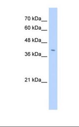 Jurkat cell lysate. Antibody concentration: 2.5 ug/ml. Gel concentration: 12%.