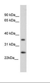 SP2/0 Cell Lysate