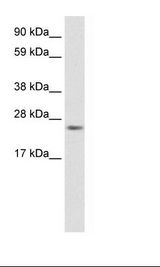 Fetal Thymus Lysate