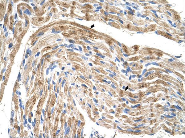 FADS1 antibody LS-C40383 was used in IHC to stain formalin-fixed, paraffin-embedded human muscle.