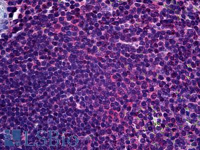 Anti-FADS1 antibody IHC of human spleen. Immunohistochemistry of formalin-fixed, paraffin-embedded tissue after heat-induced antigen retrieval. Antibody LS-B6061 concentration 5 ug/ml.