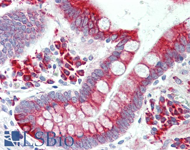 Anti-FADS1 antibody IHC staining of human small intestine. Immunohistochemistry of formalin-fixed, paraffin-embedded tissue after heat-induced antigen retrieval.