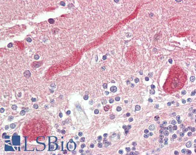 Anti-FADS1 antibody IHC staining of human brain, cerebellum. Immunohistochemistry of formalin-fixed, paraffin-embedded tissue after heat-induced antigen retrieval.