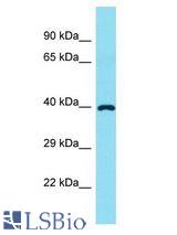 FADS6 antibody Western Blot of Fetal Liver. Antibody dilution: 1 ug/ml.