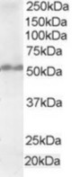 Antibody staining (1 ug/ml) of Human Testis lysate (RIPA buffer, 35 ug total protein per lane). Primary incubated for 1 hour. Detected by Western blot of chemiluminescence.
