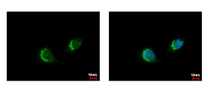 ETEA antibody [C3], C-term detects FAF2 protein at endoplasmic reticulum by immunofluorescent analysis. HeLa cells were fixed in 4% paraformaldehyde at RT for 15 min. FAF2 protein stained by ETEA antibody [C3], C-term diluted at 1:500. 