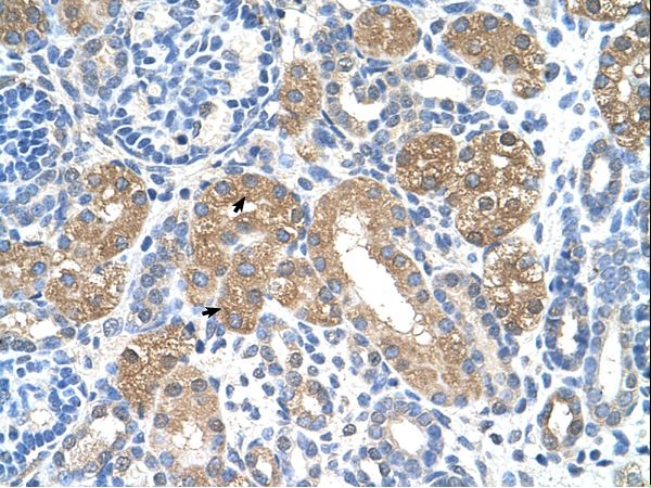 FAH antibody LS-C80449 was used in IHC to stain formalin-fixed, paraffin-embedded human kidney.