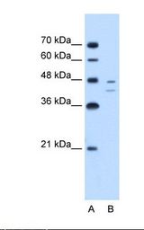 Lane A: Marker. Lane B: Jurkat cell lysate. Antibody concentration: 2.5 ug/ml. Gel concentration: 12%.