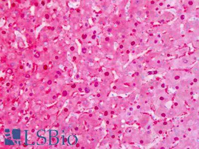 Anti-FAH antibody IHC of human liver. Immunohistochemistry of formalin-fixed, paraffin-embedded tissue after heat-induced antigen retrieval. Antibody LS-B8490 dilution 10 ug/ml.