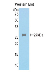 Western blot of recombinant FAH.