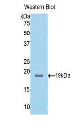 Western blot of recombinant FAH.