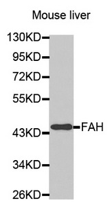 Western blot analysis of extracts of mouse live cell line, using FAH antibody.