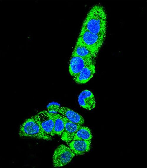 Confocal immunofluorescent of FAH Antibody with HepG2 cell followed by Alexa Fluor 488-conjugated goat anti-rabbit lgG (green). DAPI was used to stain the cell nuclear (blue).