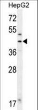 FAH Antibody western blot of HepG2 cell line lysates (35 ug/lane). The FAH antibody detected the FAH protein (arrow).