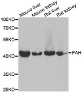 Western blot analysis of extracts of various cell lines, using FAH antibody.