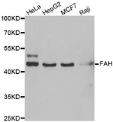 Western blot analysis of extracts of various cell lines, using FAH antibody.